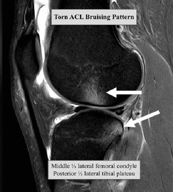 Ortho Reviews - Image